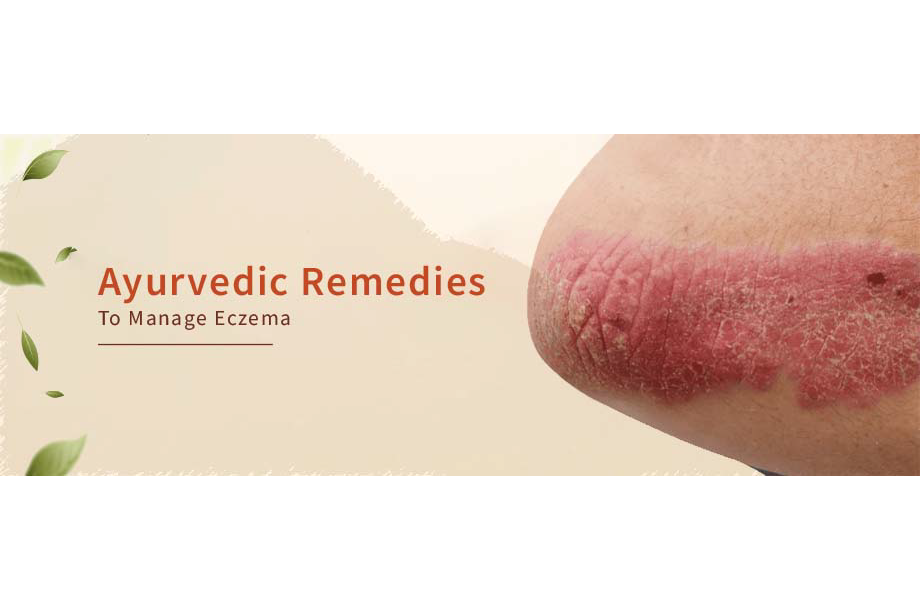 Ayurvedic Remedies To Manage Eczema 