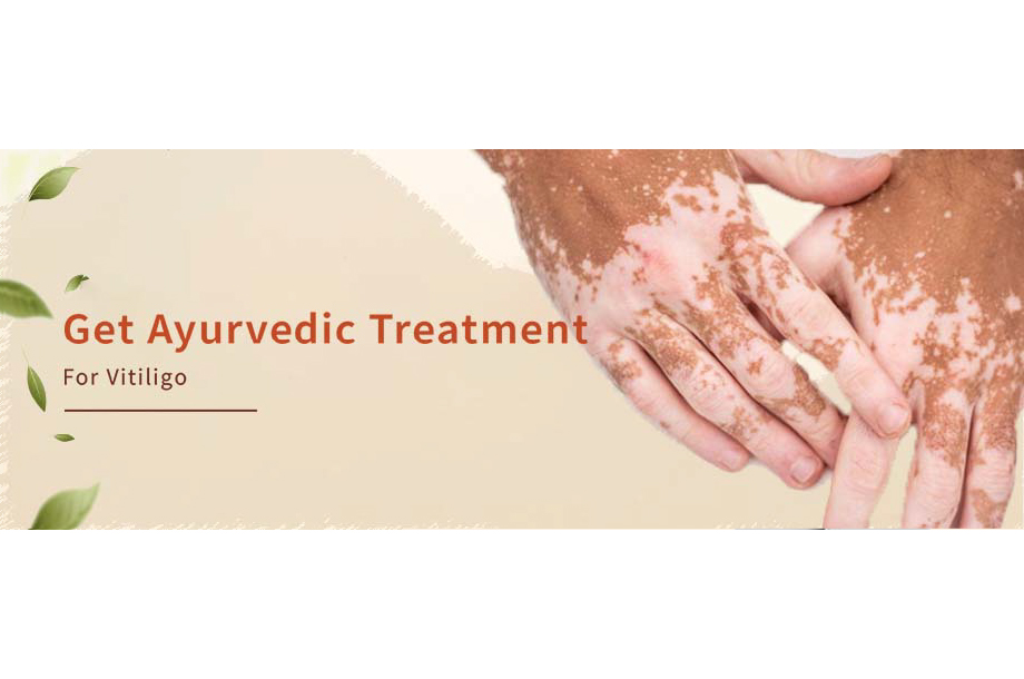 Get Ayurvedic Treatment For Vitiligo
