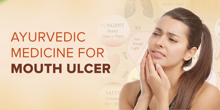 AYURVEDIC MEDICINE FOR MOUTH ULCER