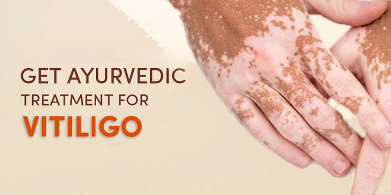 Get Ayurvedic Treatment For Vitiligo