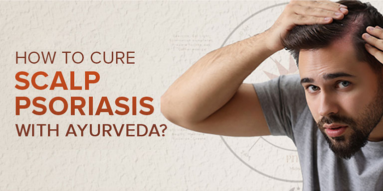 How To Cure Scalp Psoriasis With Ayurveda?