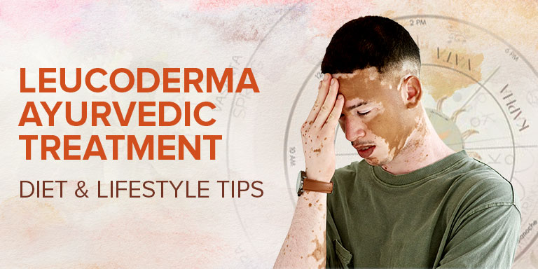 Leucoderma Ayurvedic Treatment - Diet & Lifestyle Tips