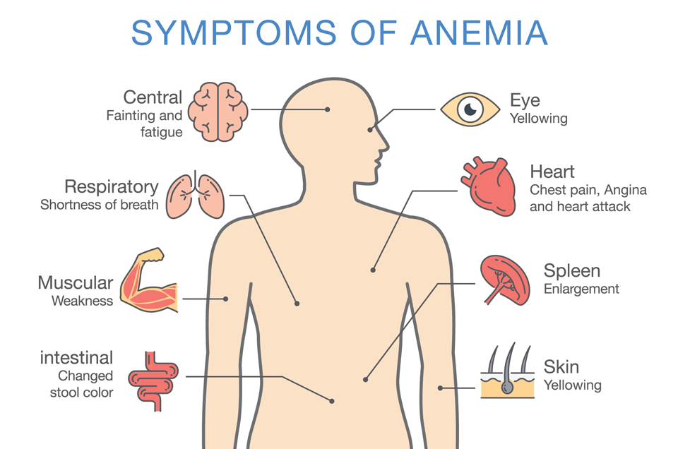 The Three Types Of Anemia According To Ayurveda Hot Sex Picture