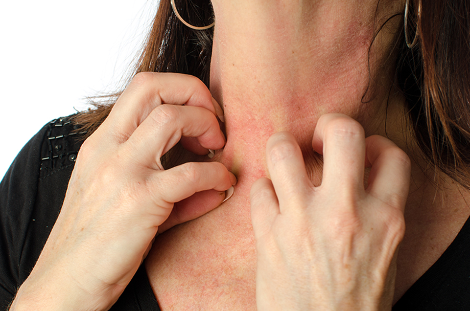 Tips For Treating The Skin Rashes According To Ayurveda Illinois Cares RX